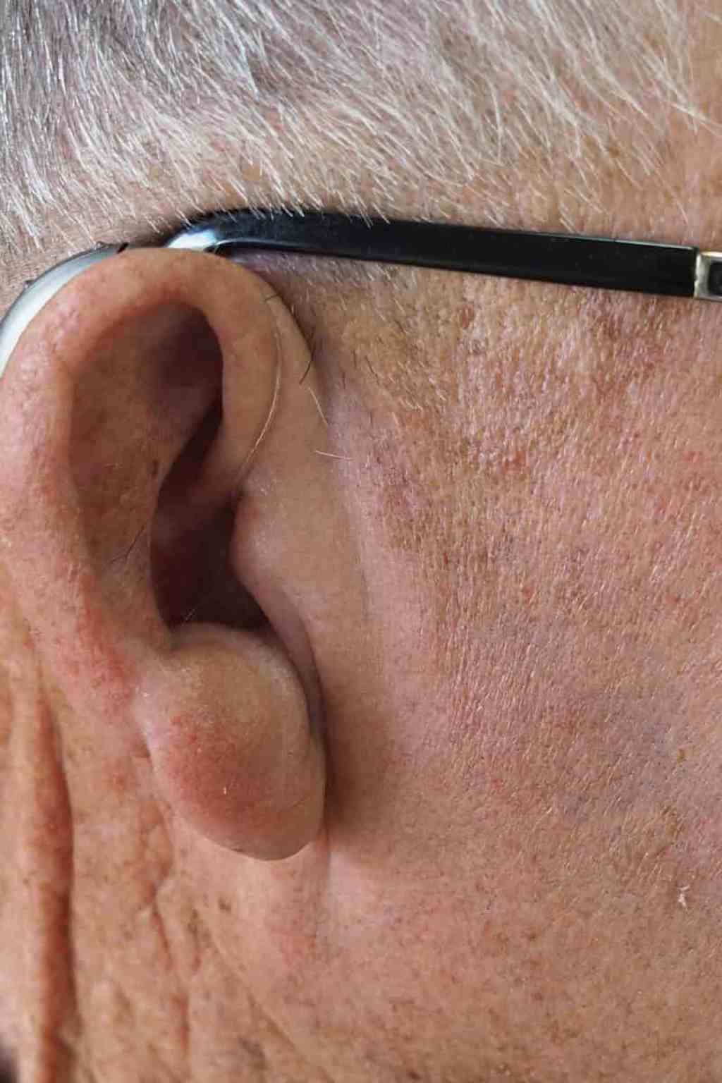 hearing aids