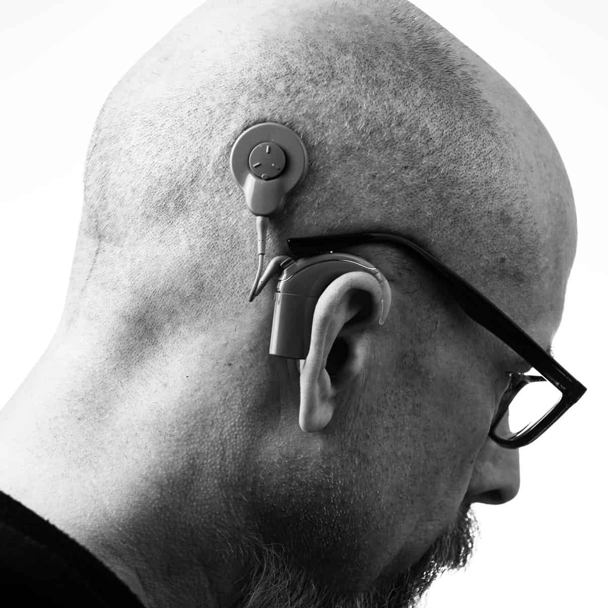 Cochlear Safety Line